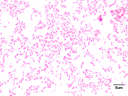 BIOL 230 Lab Manual Gram Stain Of E Coli   Ecoli01 Scale 